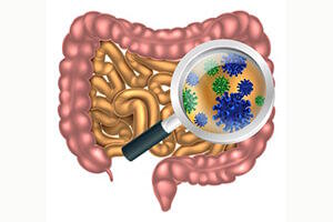 Obesity Prebiotics