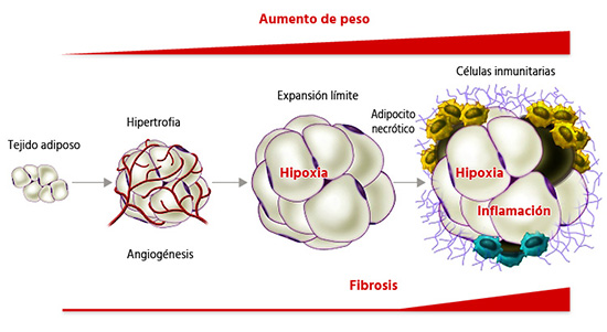 Insuline